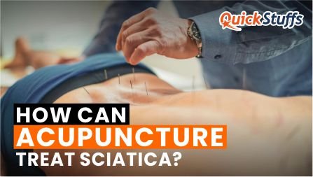 acupuncture for sciatica, sciatica acupuncture, acupuncture for sciatica pain, does acupuncture help sciatica, acupuncture points for sciatica, sciatica acupuncture points, can acupuncture help sciatica